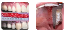 92369 CAS.webp