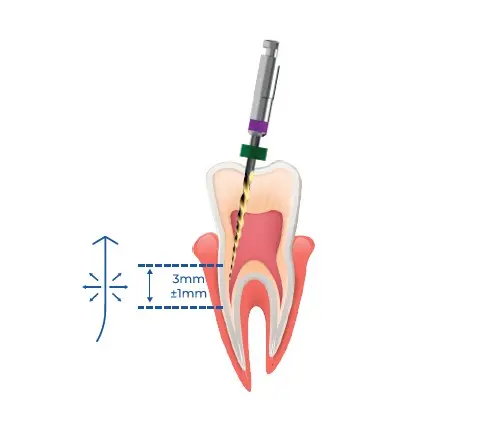 ISI Flare N25 9% L17 Plq/5